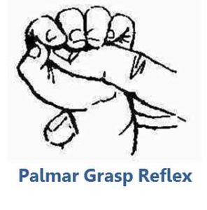 Palmar reflex